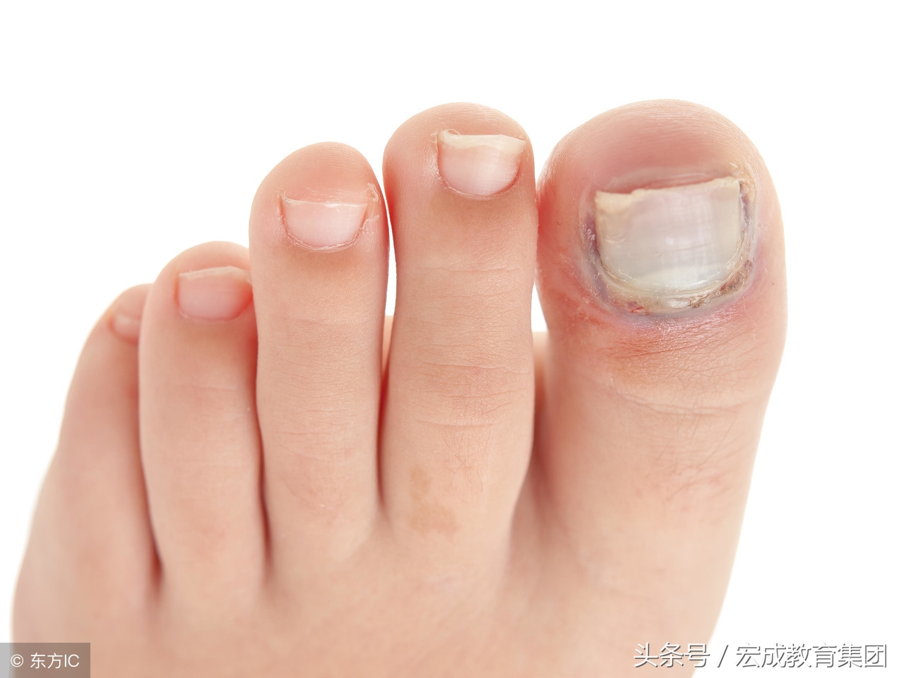 宝宝常见的皮肤病用药,常见皮肤病用药药膏有哪些