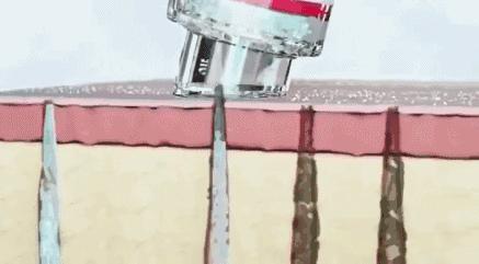 什么是小气泡项目,什么是小气泡