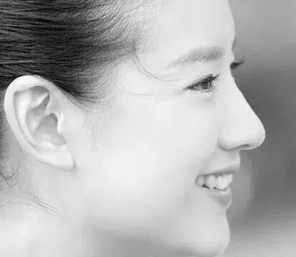 她红了半辈子，结果却因为这个脸部缺陷被骂到退圈？！