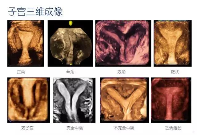 妇科盆腔彩超探头,妇科超声波探头