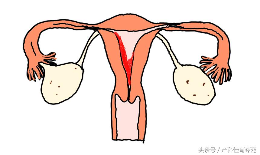 人流术后闭经，到底怎么了？