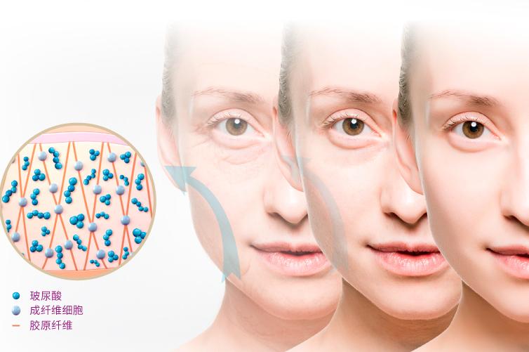 德国的胶原蛋白口服液,德国胶原蛋白玻尿酸口服液