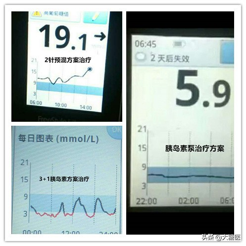 从确诊到恢复,从确诊到康复日记