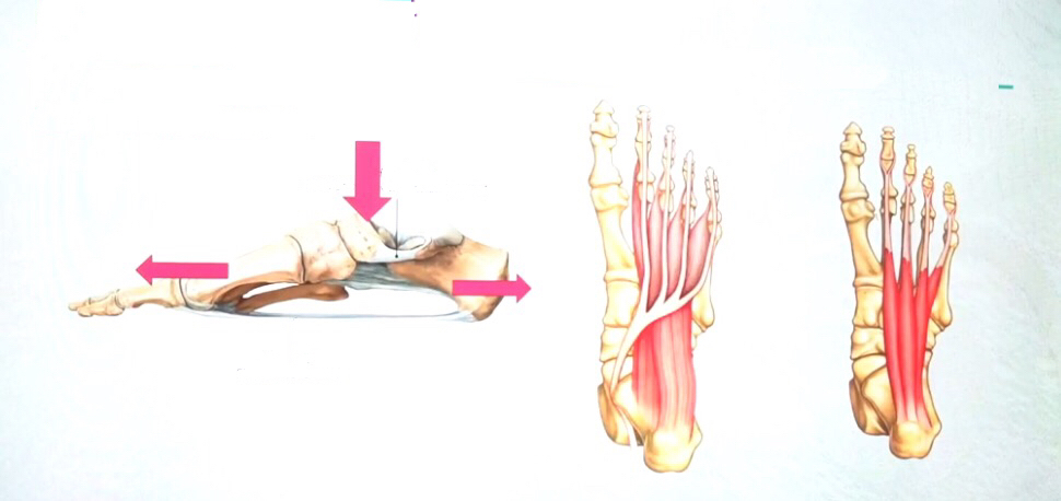产后3个月睡醒脚后跟疼怎么回事,产后脚后跟疼一招解决