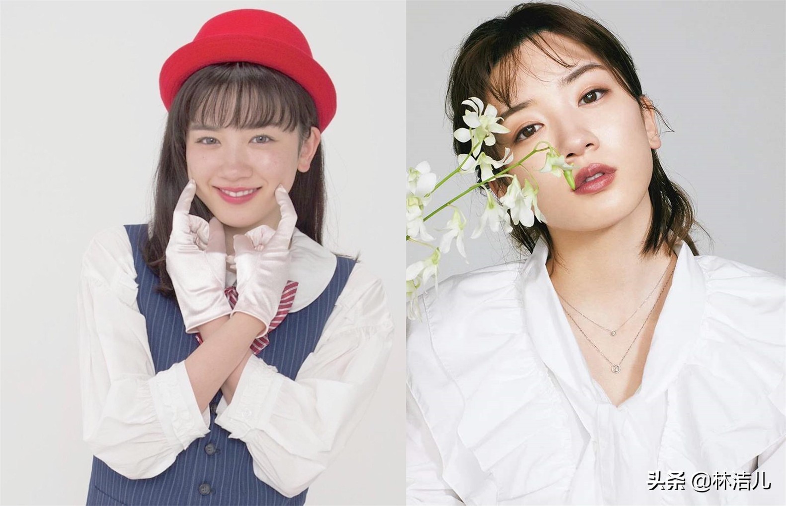 杨紫脸型变美,杨紫鼻基底前后对比