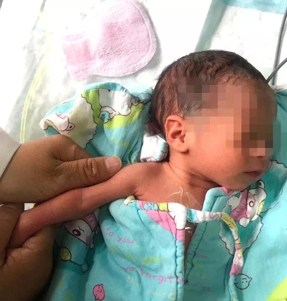 景市一院成功开展新生儿经外周静脉置入中心静脉导管（PICC）术