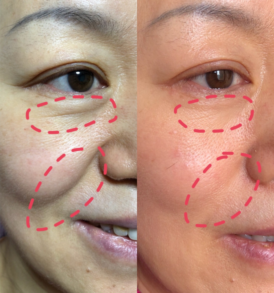 能抗氧美白的面膜,能够抗衰老的面膜