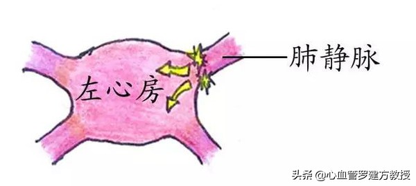 发生心律不齐，怎么样才能恢复正常？#原创首发##青云计划#