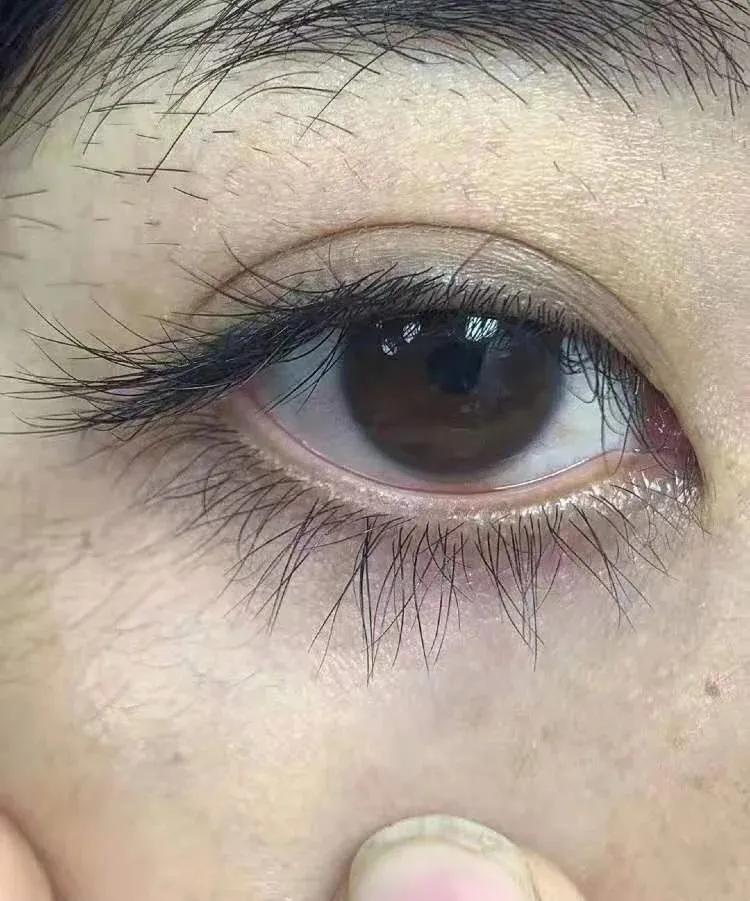 睫毛增长液日本品牌,睫毛增长液含激素吗