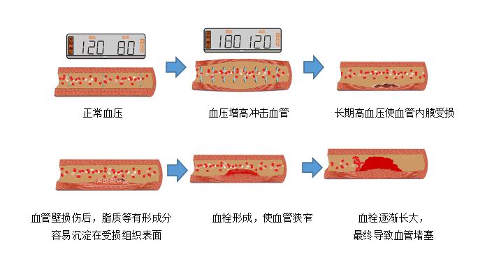 血压正常血脂会不会粘稠,血压血糖血脂每天吃药顺序