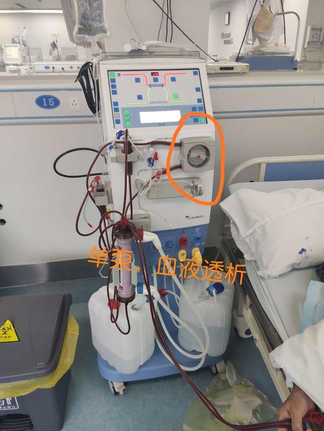 尿毒症并发症治疗,肾内科医生讲述的尿毒症患者