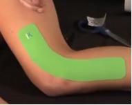 髂胫束摩擦综合征（膝外侧疼痛）跑步杀手，自我预防、康复的方法