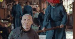 俞灏明烧伤事件真相大揭秘,俞灏明烧伤事件图片曝光