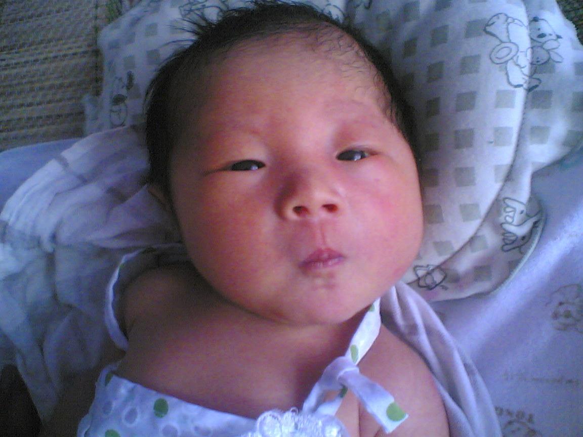 婴儿顺产被挤压的头型,顺产的时候宝宝被产道挤压了