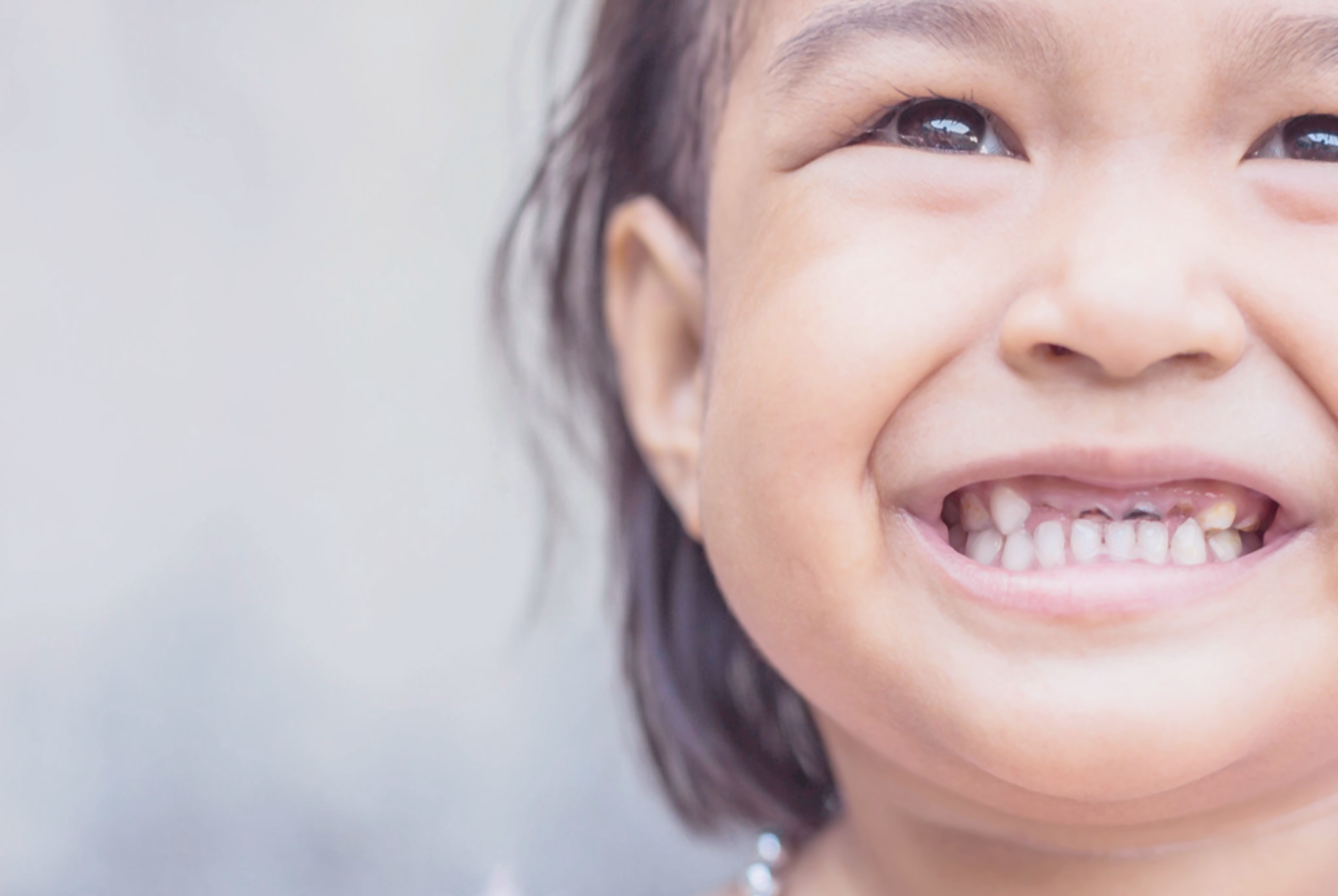 大宝蛀牙,宝宝蛀牙怎么办立刻止疼