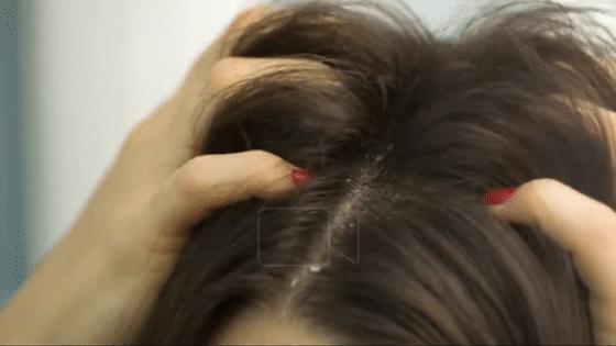 挑战3天不洗头依然干爽不油腻,4天不洗头头发就油了正常吗