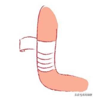 专家级指导：外伤后如何包扎伤口