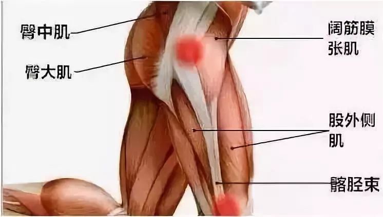 跑步臀部关节痛怎么恢复,跑步跑的腿疼屁股疼