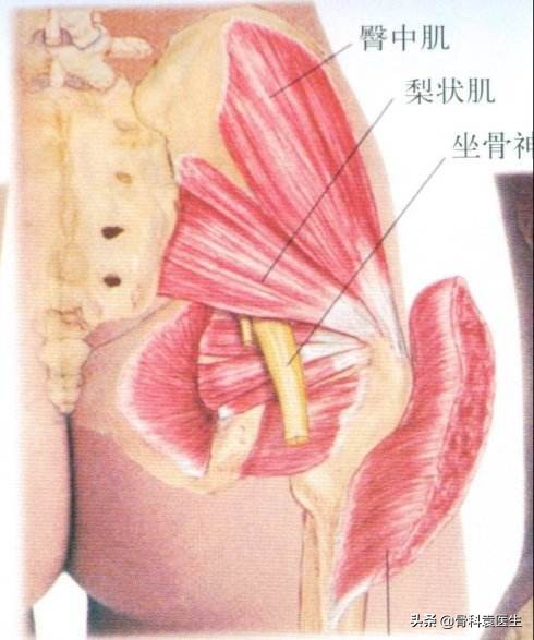 咳嗽引发坐骨神经痛啥原因,坐骨神经痛是什么原因引起的男士