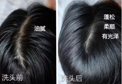 头发蓬松茶树油洗发水,油头救星澳洲茶树洗发水