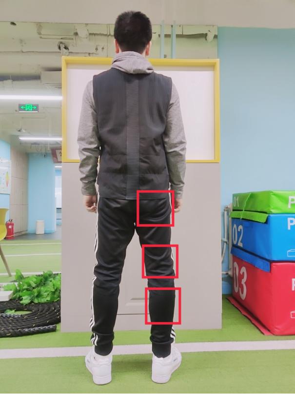 健康科普：腰椎L3-L4膨出，L4-L5突出，L5-s1脱出是什么意思