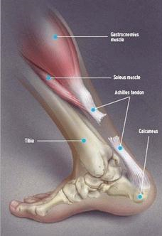 跟腱断裂轻度功能障碍鉴定标准,跟腱出现问题前有什么表现