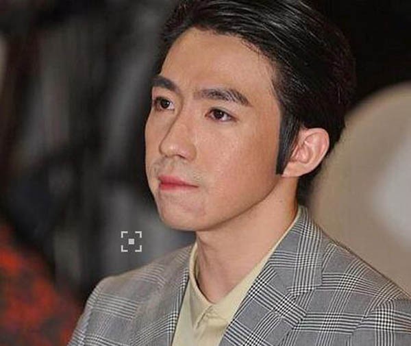 从毁容到重生,从美男子到毁容俞灏明如今怎样了