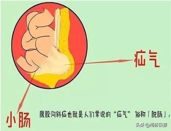 一周岁以下儿童小肠气,13个月的宝宝小肠气