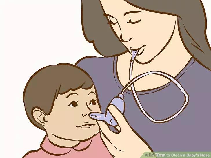 鼻腔冲洗器哪个喷头力度大,洗鼻器家用鼻腔冲洗正确使用方法