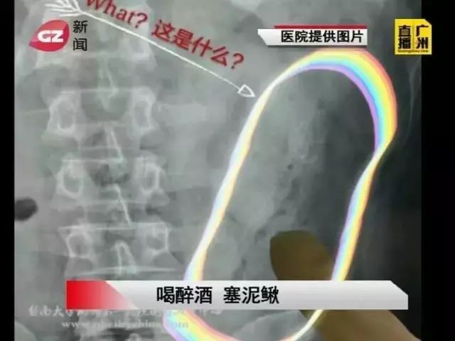 肛门塞异物很刺激？医生忙说：别乱来，快感之后全是悲伤