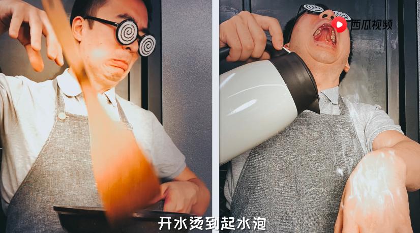 深二度烫伤和浅二度烫伤对比图片,烫伤的泡变暗红色