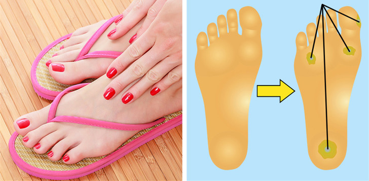 鞋子磨脚怎么软化鞋子,新鞋磨脚怎么处理鞋子