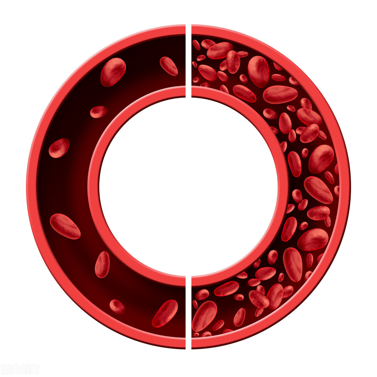 中年妇女缺铁性贫血吃什么补品,女性容易缺铁性贫血