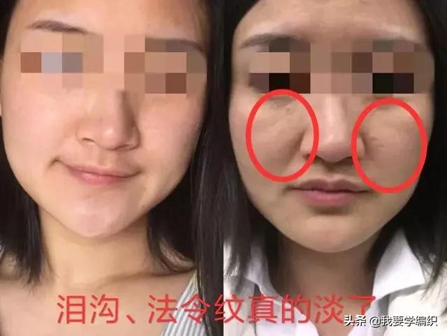 冬天脸干,连皱纹都出来了?日本女博士教你一招,抹几下白白嫩嫩