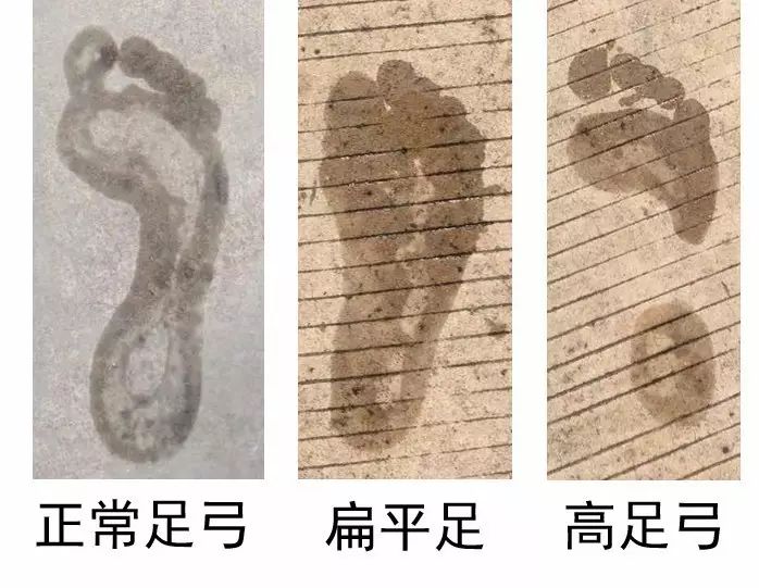 怎样选一双平价又合适的跑鞋,撸起袖子跑步