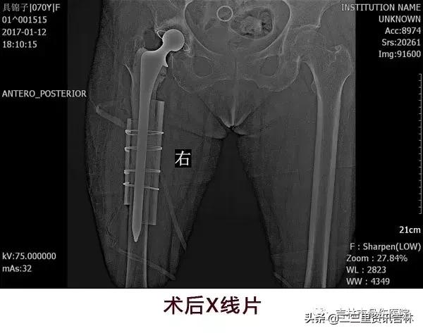 从医30余年，他治疗数以万计骨伤骨病患者