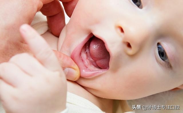 小宝换牙之前牙齿很小很整齐,宝宝牙齿不整齐换牙后会好吗