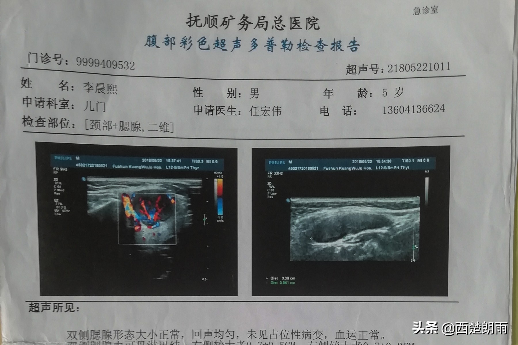 母子同患癌救孩子,母子同患癌舍己救子