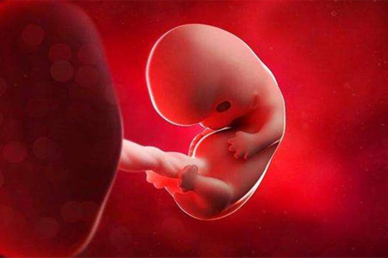 吃了药发现怀孕孩子会畸形吗,吃了药怀孕导致胎儿畸形的案例