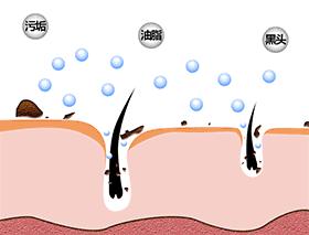 不骗人的去黑头,无声去黑头