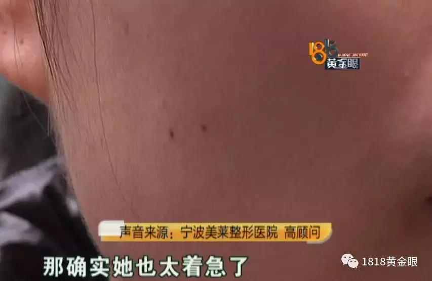 打完瘦脸针青蛙腮多久消失,打完瘦脸针出现哇噻是因为什么