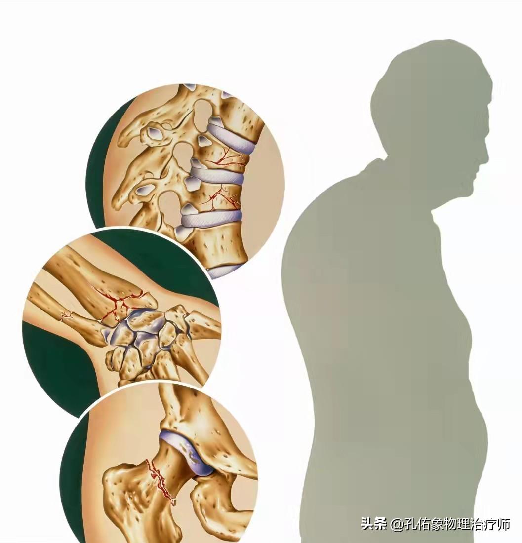 老年人腿脚无力要怎么避免,专治老年人下肢无力的方法