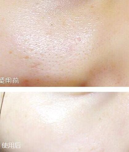 女人千万别去美容院,不建议去美容院做美容