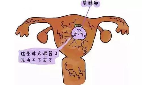 为什么胎停育越来越多,为什么胎停育会引起流产