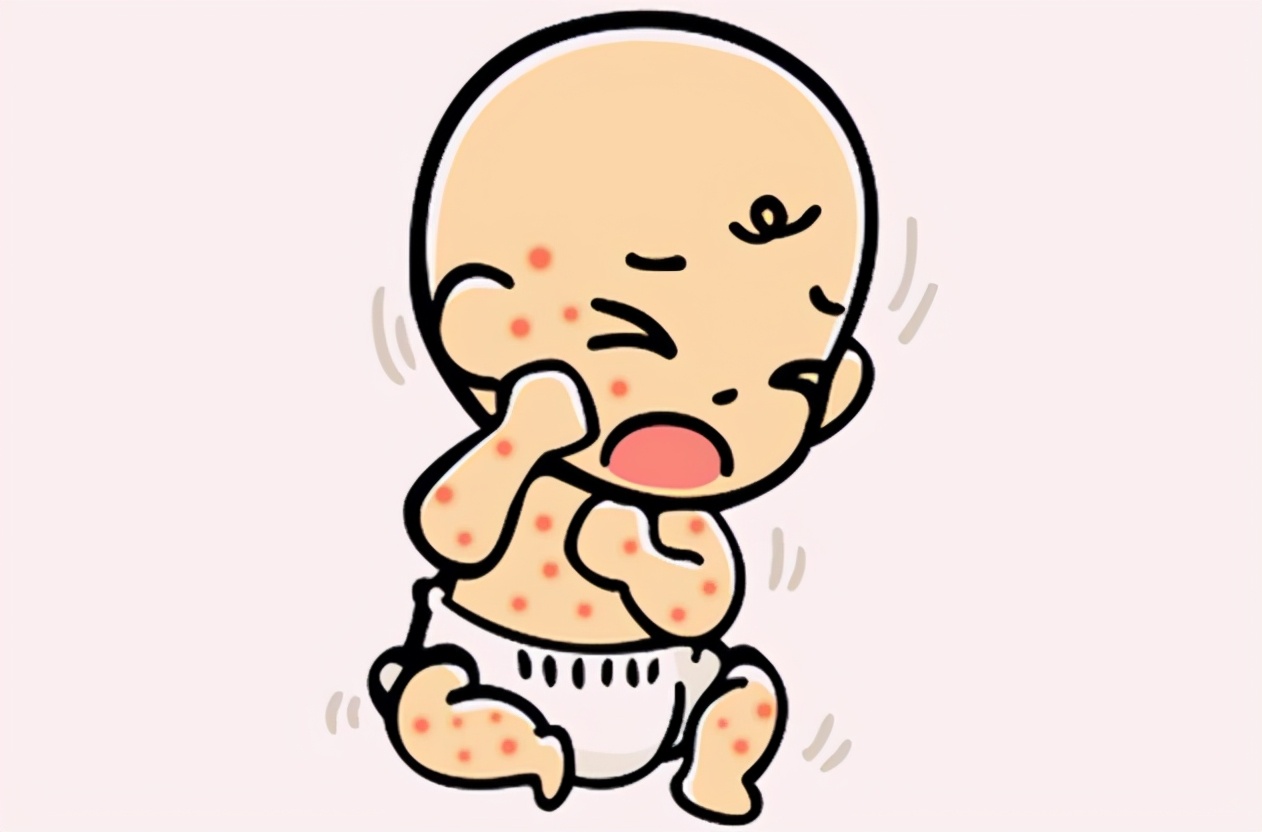 湿疹为何不痒,湿疹不疼不痒怎么治疗和根除