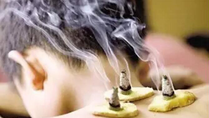 艾灸祛寒什么原理,艾灸散寒的功效与作用