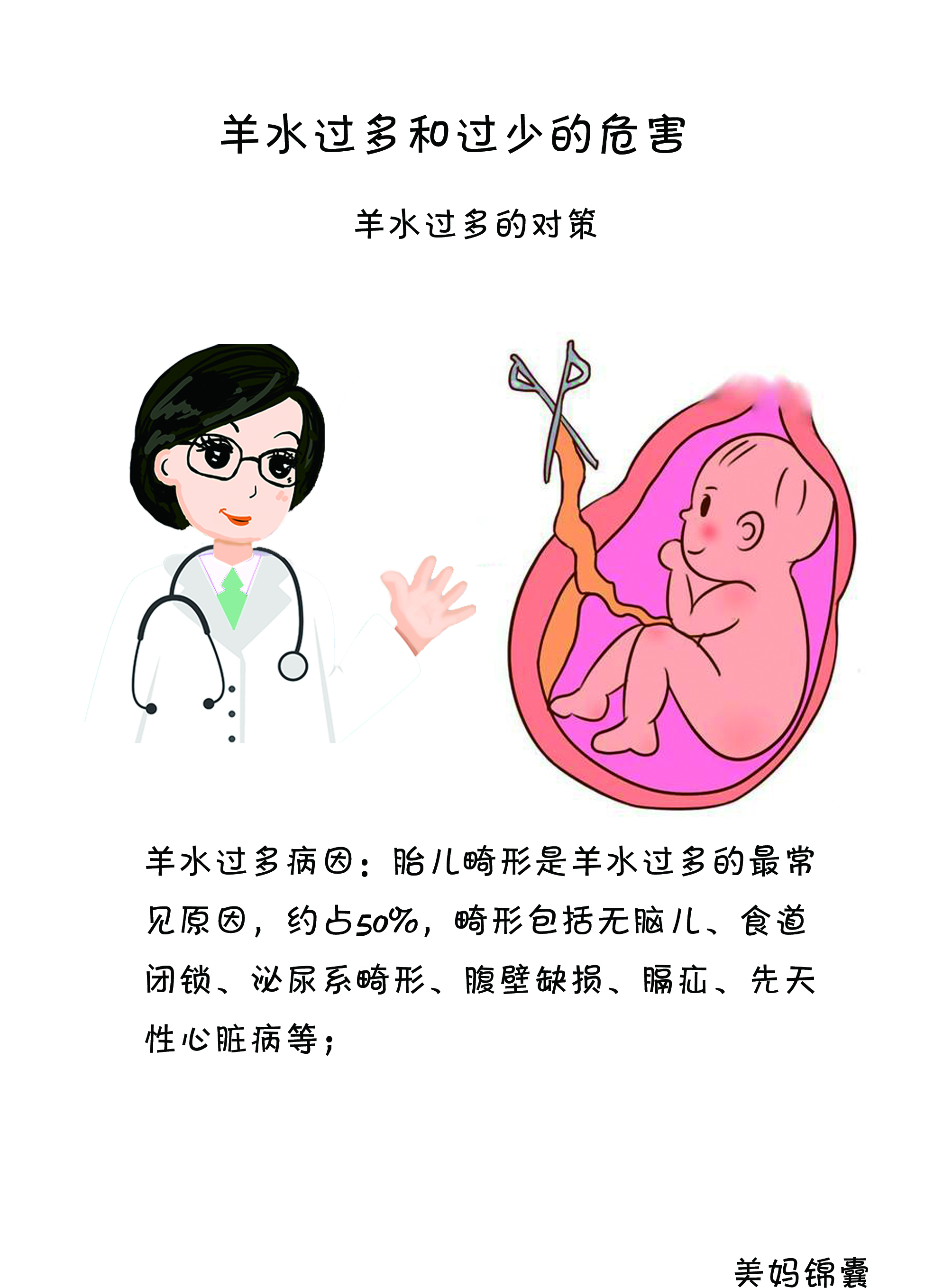 羊水过多的处理方法,羊水过多275mm