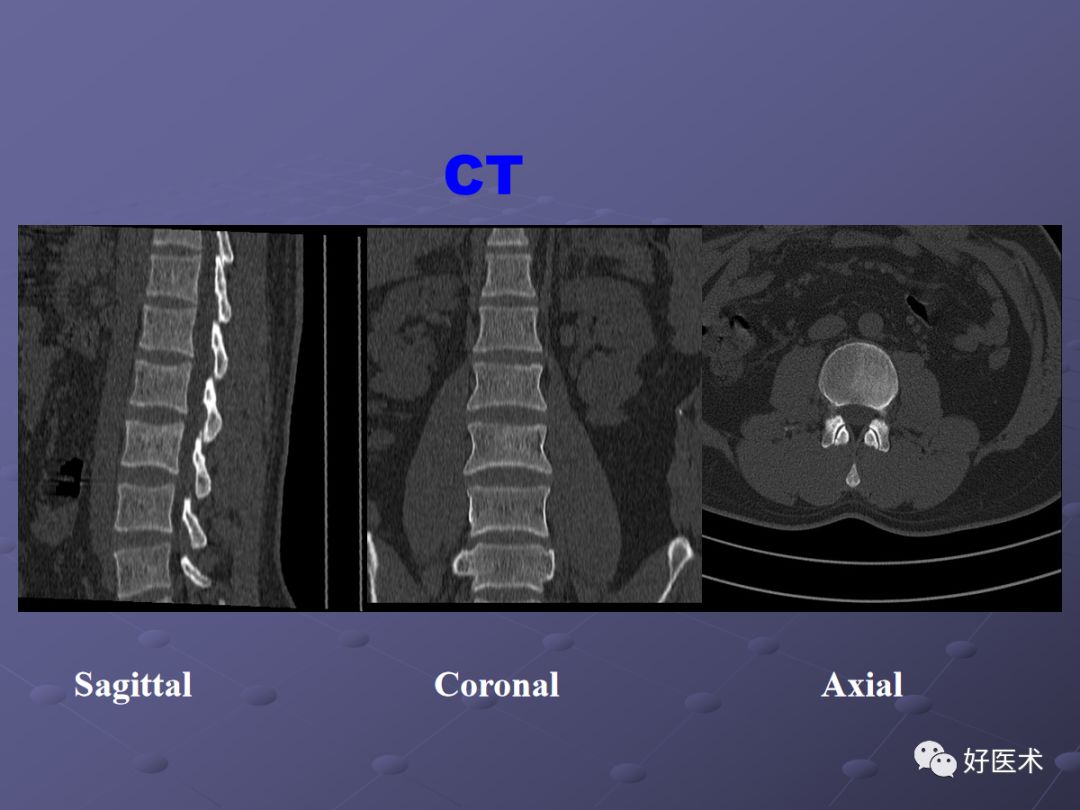脊柱mri有哪些特点,乳腺疾病的mri诊断及鉴别