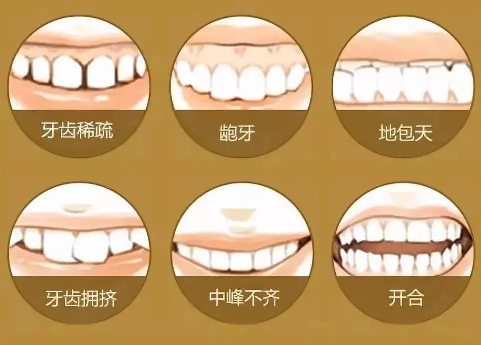 错颌畸形导致的脸歪矫正,矫正偏颌是什么原因导致的