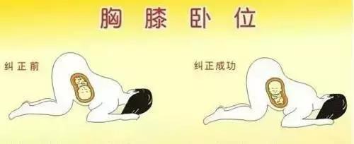 39周胎位不正纠正方法,胎位不正可以从几个月胎位纠正